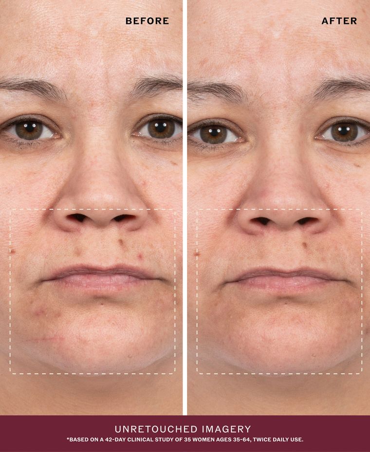Before and after, unretouched