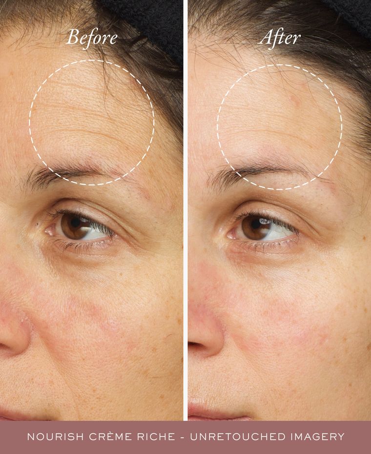 Before and after, unretouched