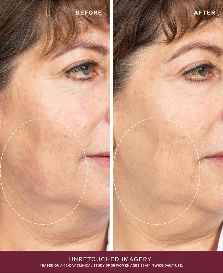 Before and after, unretouched