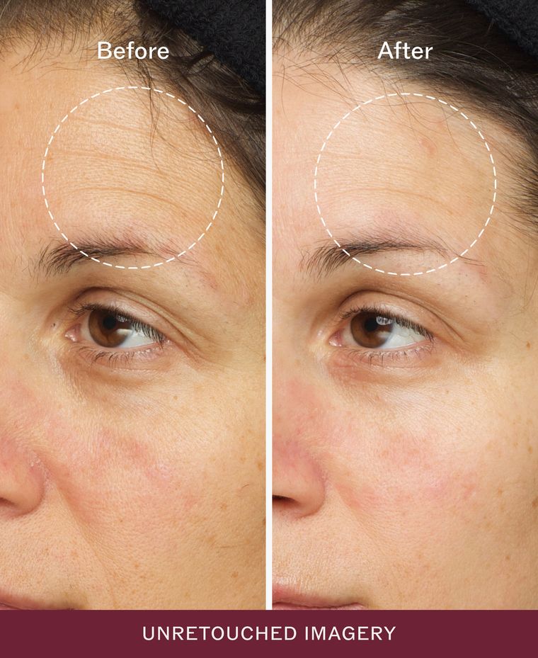 Before and after, unretouched
