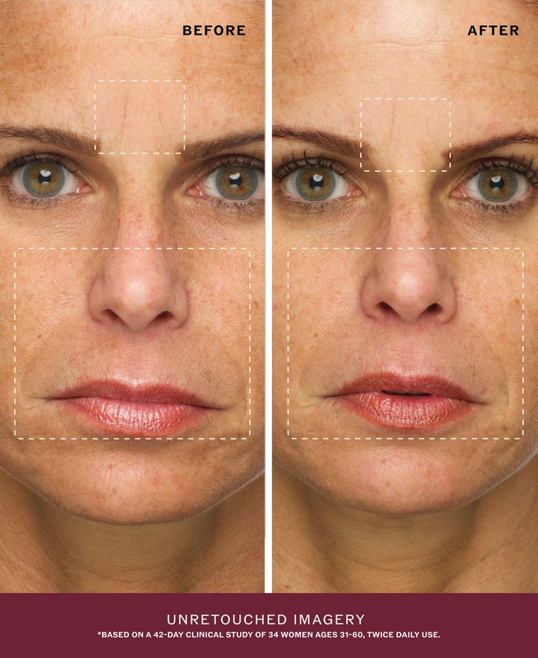 Before and after, unretouched