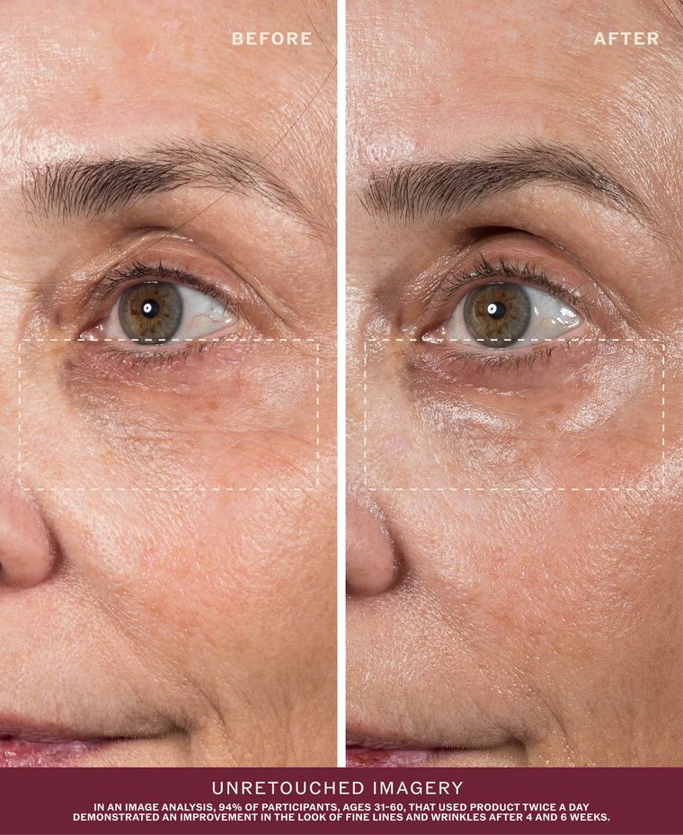 Before and after, unretouched