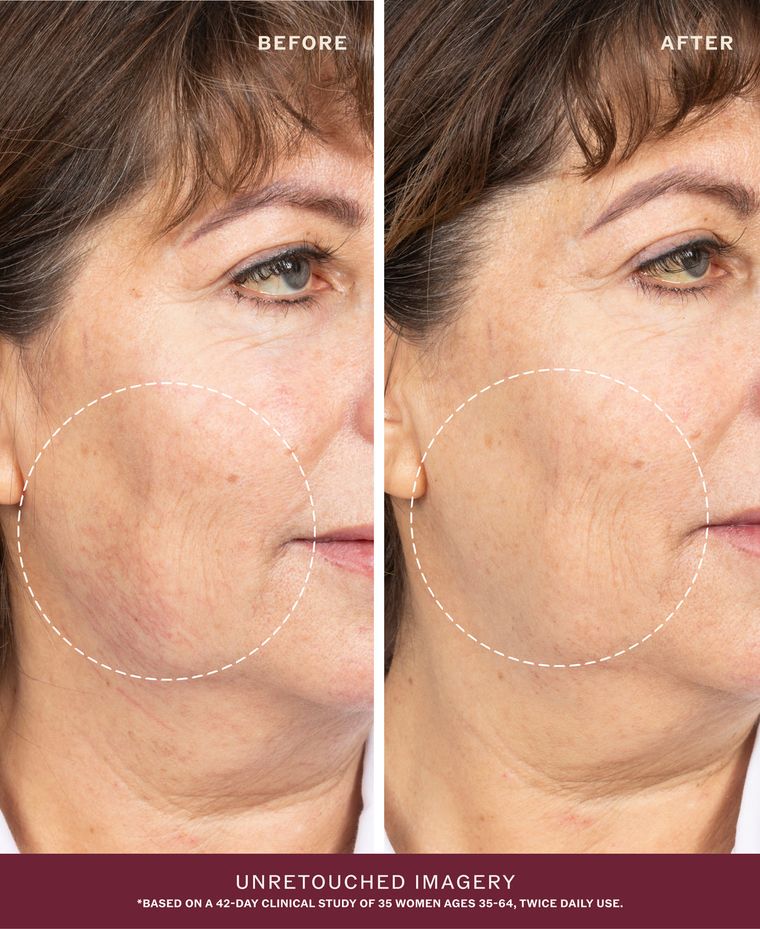 Before and after, unretouched