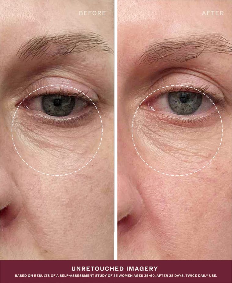 Before and after, unretouched